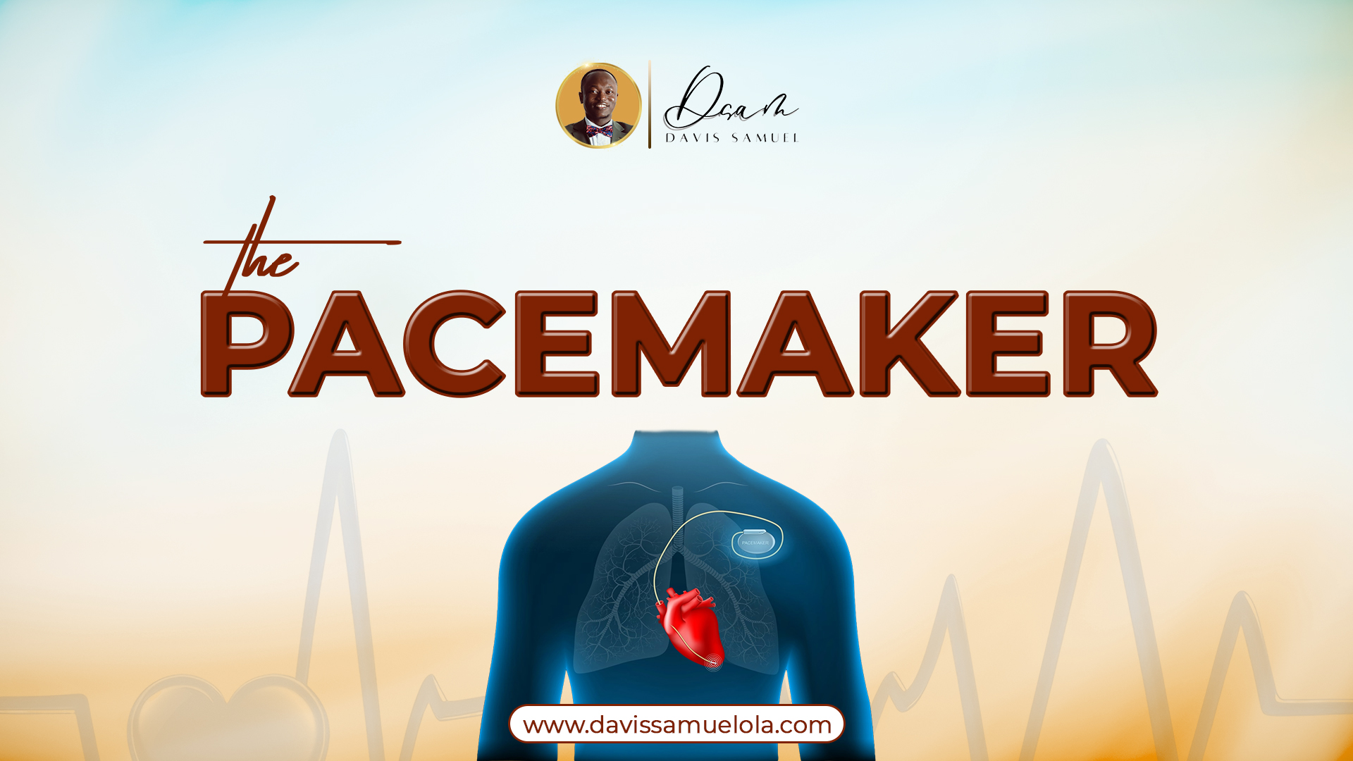 The Pacemaker